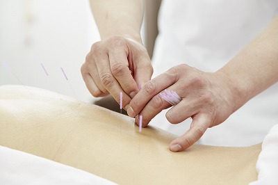 鍼灸治療